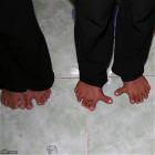 Crazy Toes