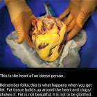 Fat Heart