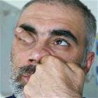 Finger Way Up The Nose