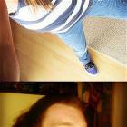 Fixing The Duck Face