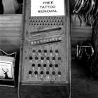 Free Tattoo Removal