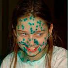 Green Dots