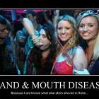 Hand And Mouth Disease