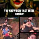 How I Got These Scars