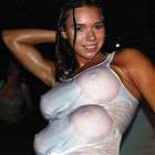 Implants
