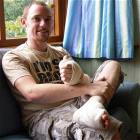 James Byrne Toe Thumb