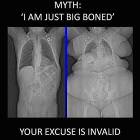 Just Big Boned