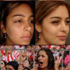 Larissa Riquelme Plastic Surgery