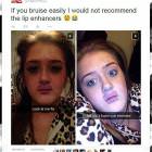 Lip Enhancers