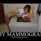Mammogram