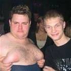 Man Boobs