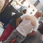 My Bald Friends
