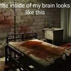 My Brain