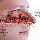 Nasal Congestion