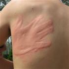 Nice Slap Mark
