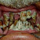 Nice Teeth