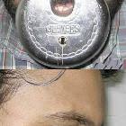 Nose Disker