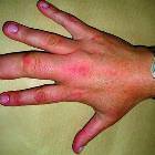 Phat Finger