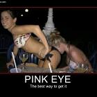 Pink Eye