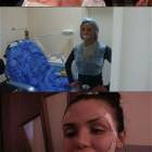 Plastic Surgery