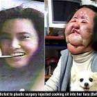 Plastic Surgery Addict