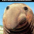 Pre Surgery