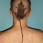 Rat Tail