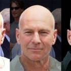 Resemblance