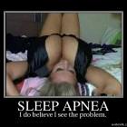 Sleep Apnea