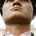 Stiff Neck
