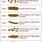 Stool Chart