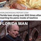 Stung A Couple Times