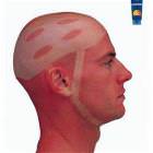 Sunburns Picdump 3