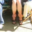Swollen Ankles