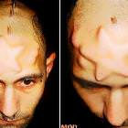Swollen Brain