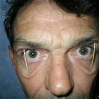 Tooth Pick Eyes