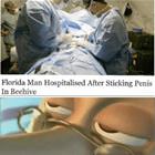 We All Make Mistakes