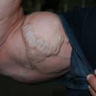 Weird Vein