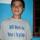 Work For Implants